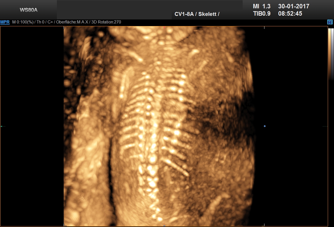 Ultraschall 24SSW 01
